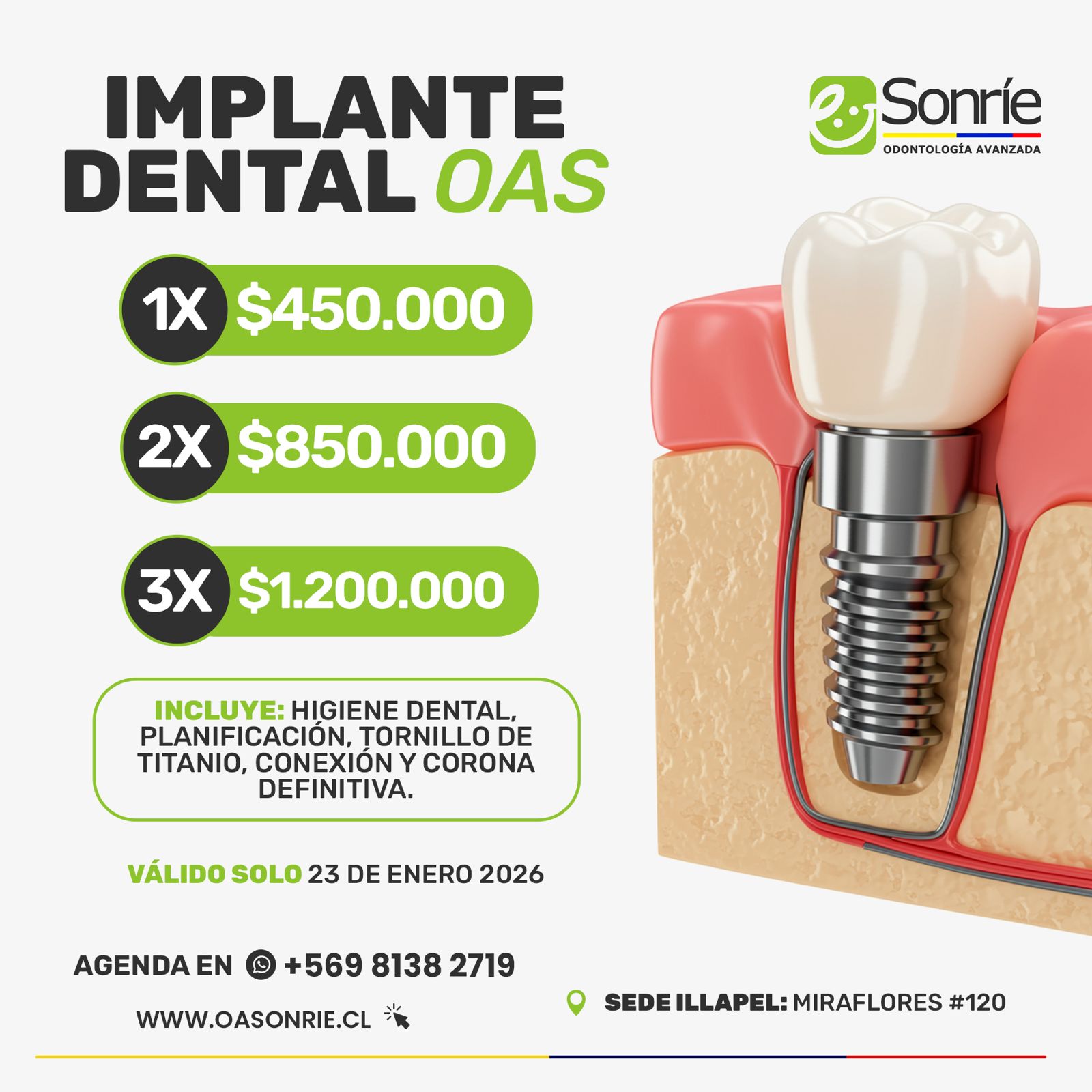 implante dental