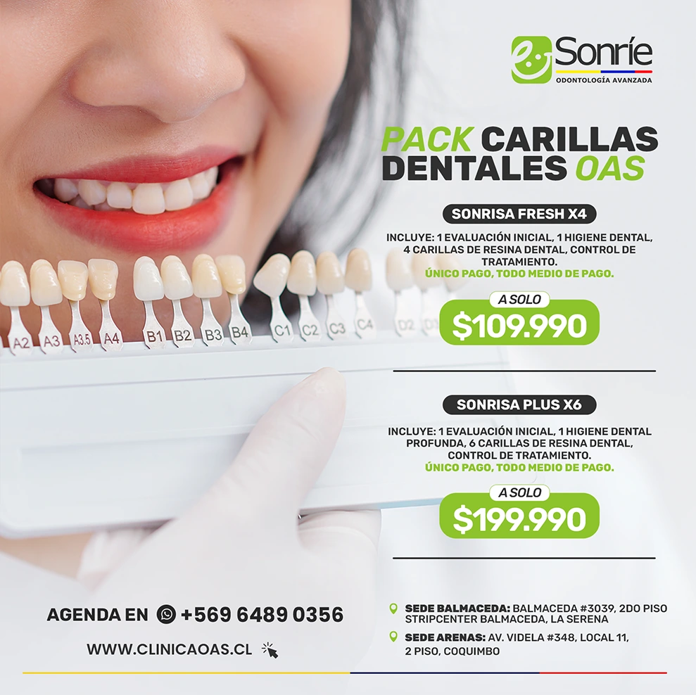 pack carillas dentales