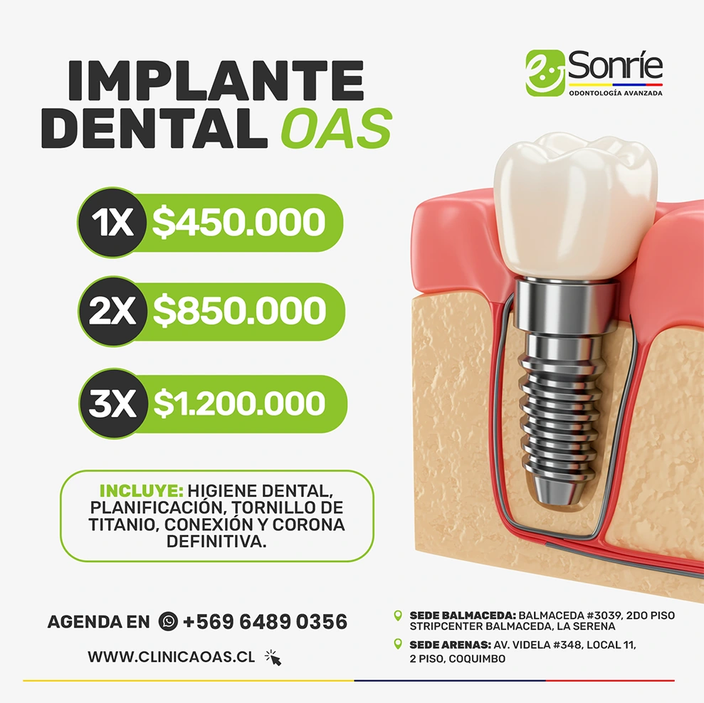 implante dental